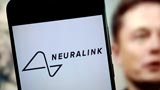 Il secondo paziente Neuralink gioca a Counter-Strike e lavora con software CAD usando la mente