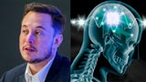 Neuralink cerca partner per i primi impianti sperimentali umani