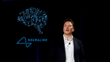 Neuralink, la comunit&agrave; scientifica &egrave; preoccupata per la mancanza di informazioni sul primo esperimento umano
