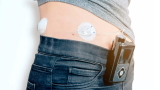 "Pancreas artificiale": rivoluzione nella gestione del diabete. Cos'&egrave; e come funziona